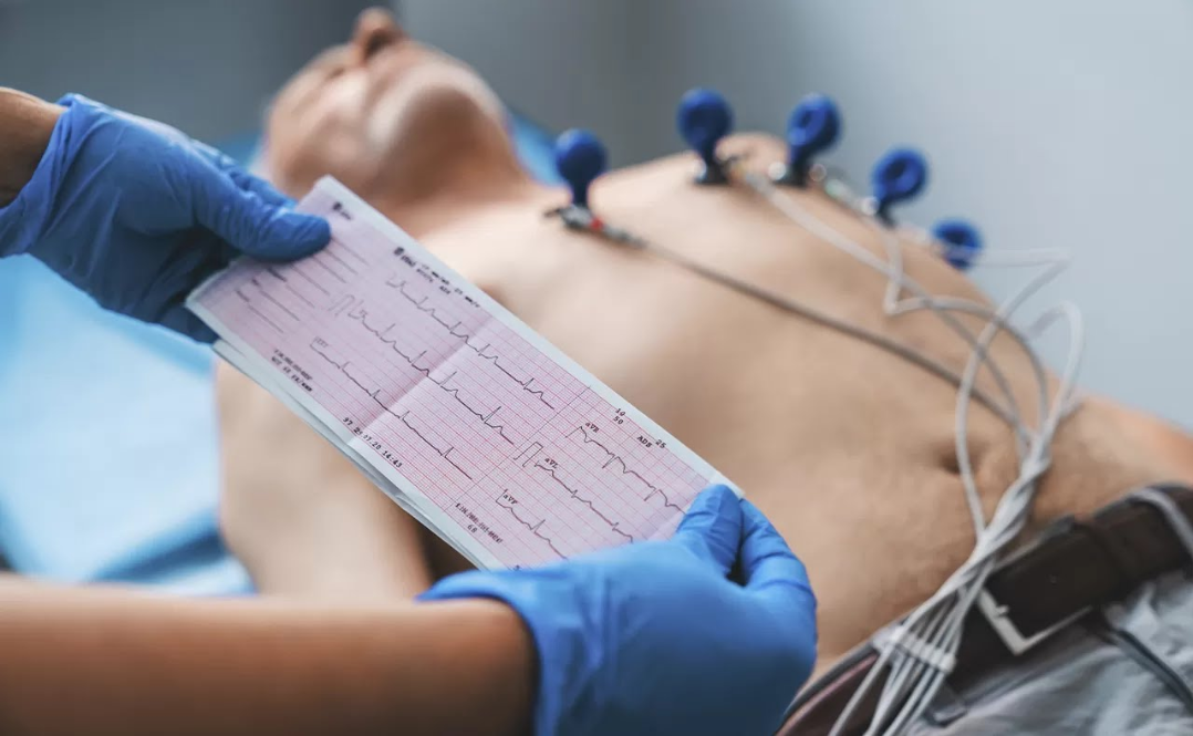 Etapa da consulta cardiológica: Eletrocardiograma